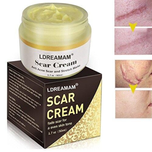 High Time Razor Bump Treatment, Double Strength 0.5 Oz